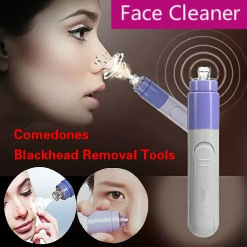Mini Electric Facial Pore Blackhead Removers Skin Care Tool Cleanser Vacuum Face Dirt Suck Up Acne 1 Mini Electric Facial Pore Blackhead Removers Skin Care Tool Cleanser Vacuum Face Dirt Suck Up Acne 3