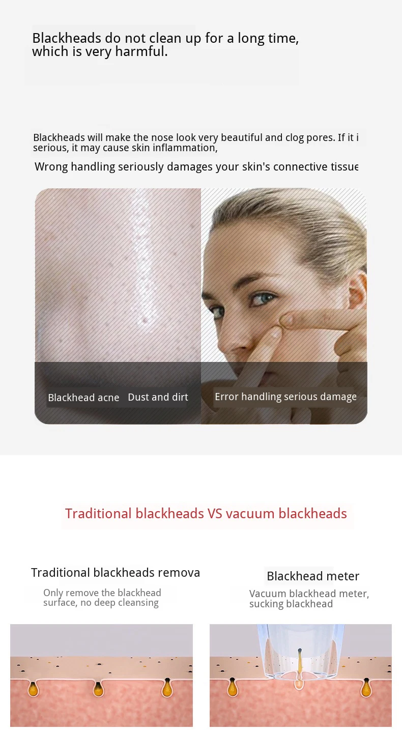 Removedor de Cravo Poros Limpeza Sugar Acne Graxa Melhorar Horny Cupping Massagem Aspirador Preto Dot Espinha Removedor Ferramenta 3d 9 Utensílios de cuidado facial