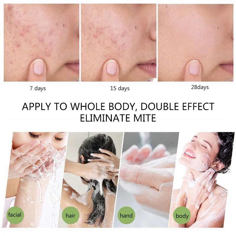 Rffective Handmade Tea Tree Oil Soap Mites Removal Soap Anti-mites Shrinking Pores Rffective Handmade Tea Tree Oil Soap Mites Removal Soap Anti-mites Shrinking Pores