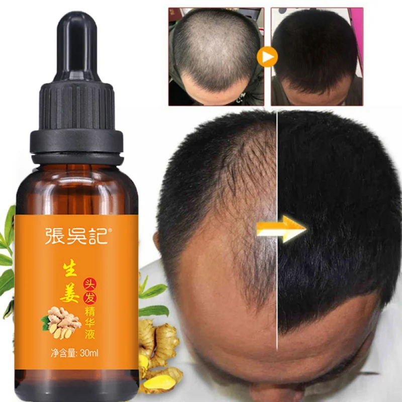 30ml Anti-fork Hair Regrowth Treatment Product Long Lasting Ginseng Hair Growth Solution Nourish Hair Scalp