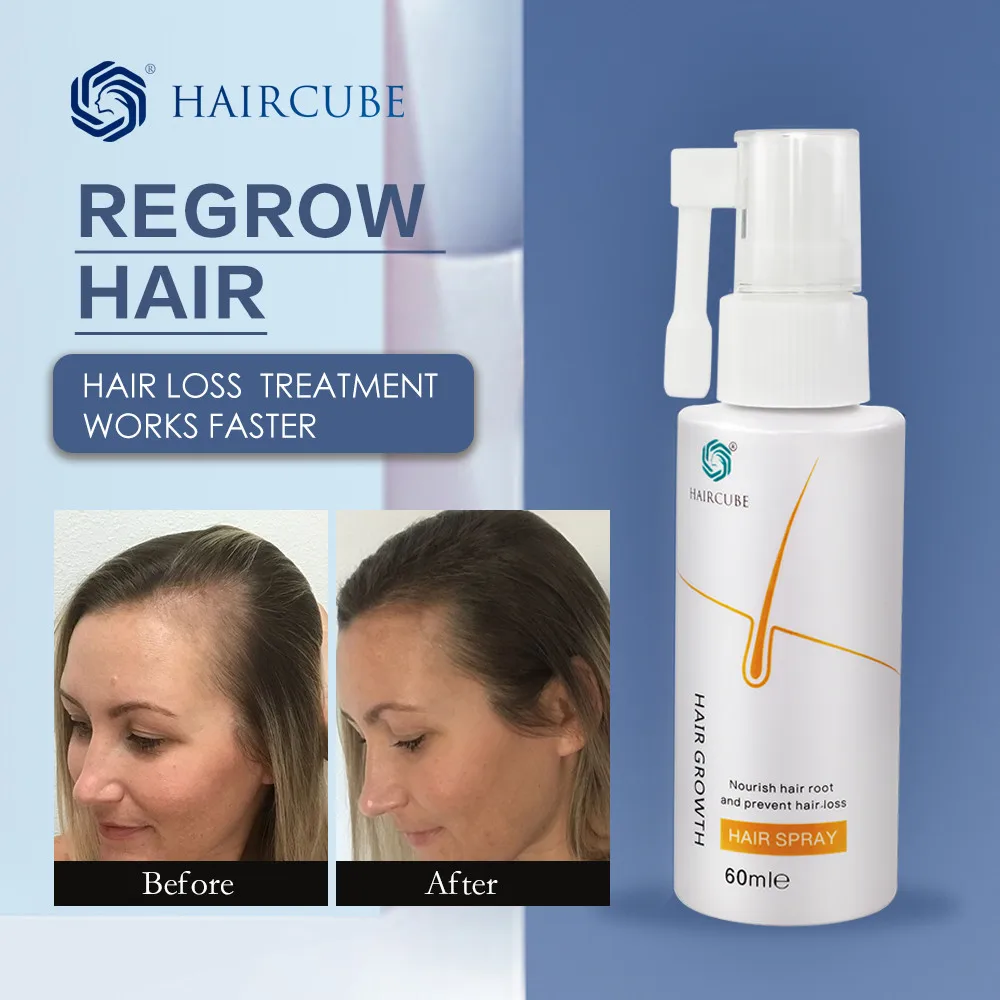 Productos contra la caída del cabello para hombre aerosol para el crecimiento del aceite líquido, suero esencial para el crecimiento del cabello, cuidado y reparación del cabello -