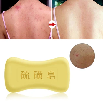 

80g /130g Chinese traditional sulfur soap oil-control acne treatment blackhead remover soap Whitening cleanser