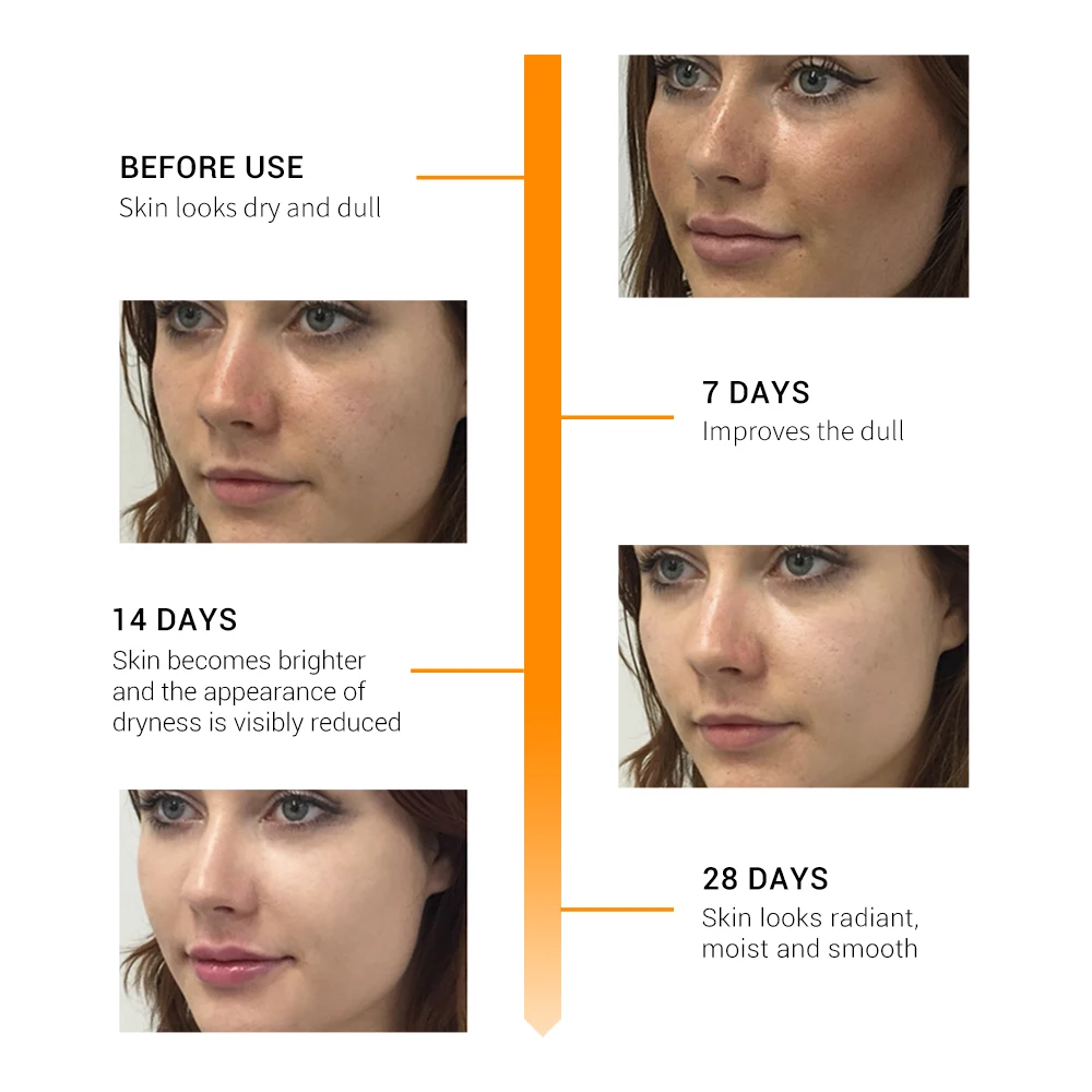 BREYLEE Face Serum Vitamin C Whitening Facial Serum Remove Melanin Dark Spots Freckle Removal Brightening Ageless Skin Care 17ml BREYLEE Face Serum Vitamin C Whitening Facial Serum Remove Melanin Dark Spots Freckle Removal Brightening Ageless Skin Care 17ml