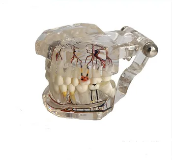 

Dental teeth model implant with nerve Transparent pathological Repair model Teaching demonstration model