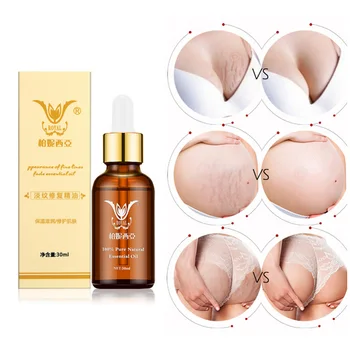 

Stretch Mark Remover Essential Oil Skin Care Treatment Nourishing Whitening Pregnancy Repair Oil