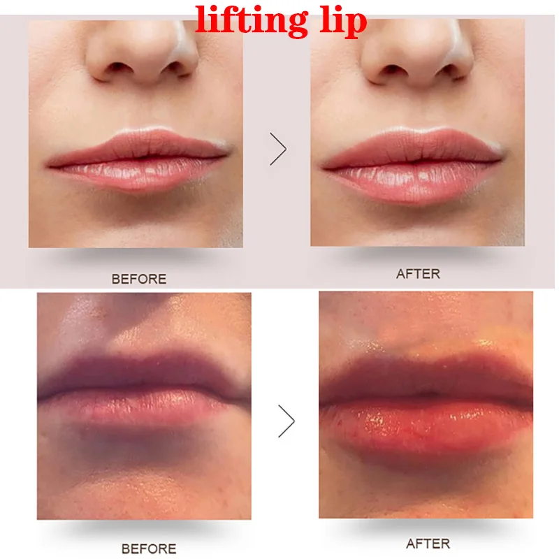  Hyaluron Pen Atomizer Hyaluronic Pen Wrinkle Removal Anti aging Lifting Lip Filler High Pressure Be