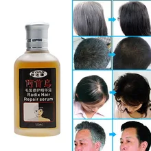 Эфирные масла для роста волос, жидкость для выпадения волос, 50 мл, густые волосы, многоцветность, продукт для мужчин и женщин, эссенция китайской медицины