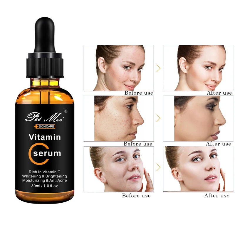 Vitamin C Facial Serum Deeply Moisturizing Remove Dullness Whitening Face Essence Anti Acne Anti Age Skin Care Product 30ml Face Serum Aliexpress