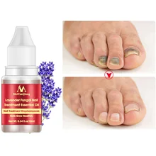 10 мл Лечение грибка ногтей против грибковых ногтей, уход за ногтями, эфирное масло лаванды для продажи