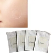 Прыщи, акне набор патчей для лечения угрей, лечение акне, набор инструментов для удаления, изолировать шрам от акне, противовоспалительный, быстро удаляет стикер