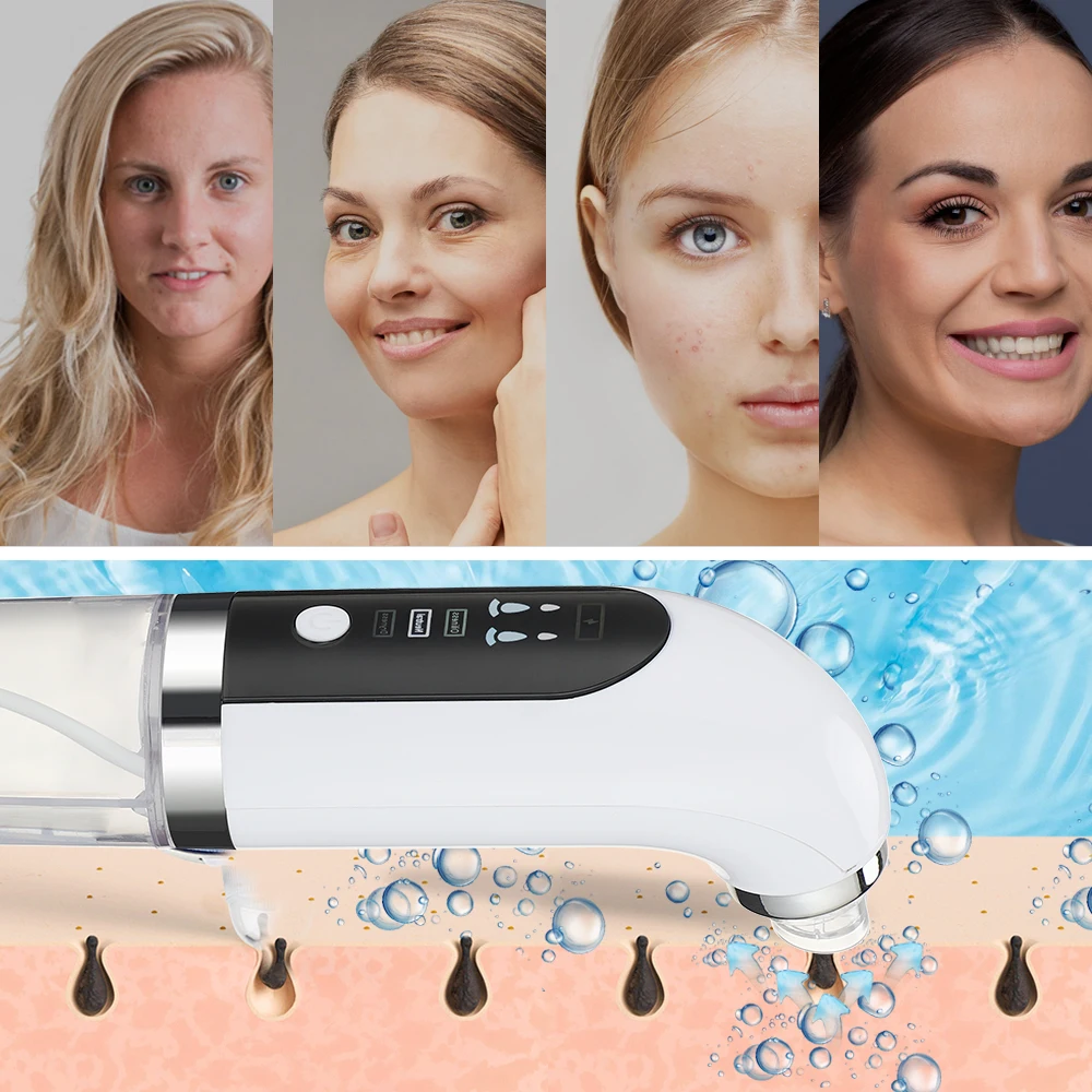 Electric Small Bubble Blackhead Remover ,USB Rechargeable Vacuum SuctionWater Cycle Pore Cleaner ,Acne Pimple Black Head Extractor, Blackhead Removal ,Facial Cleaner Tool,Face Skin Care Tools with 3 Adjustable Suction Levels & 6 Replaceable Suction Heads