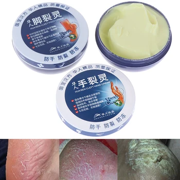 

Feet and hand Care Repair Cream Removal Dead Skin Hand Traditional Chinese Oil Anti-Drying Crack Foot Cream Heel Cracked