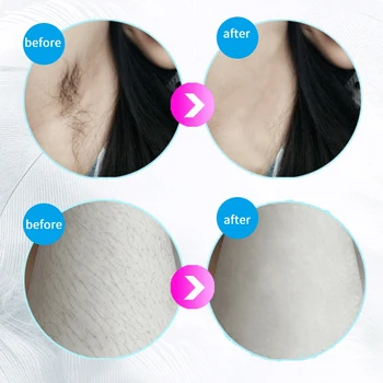 

hot sale IPL Hair Removal System for Women Permanent Painless UPGRADE To 600,000 Flashes Facial Body Profesional Hair Remover De