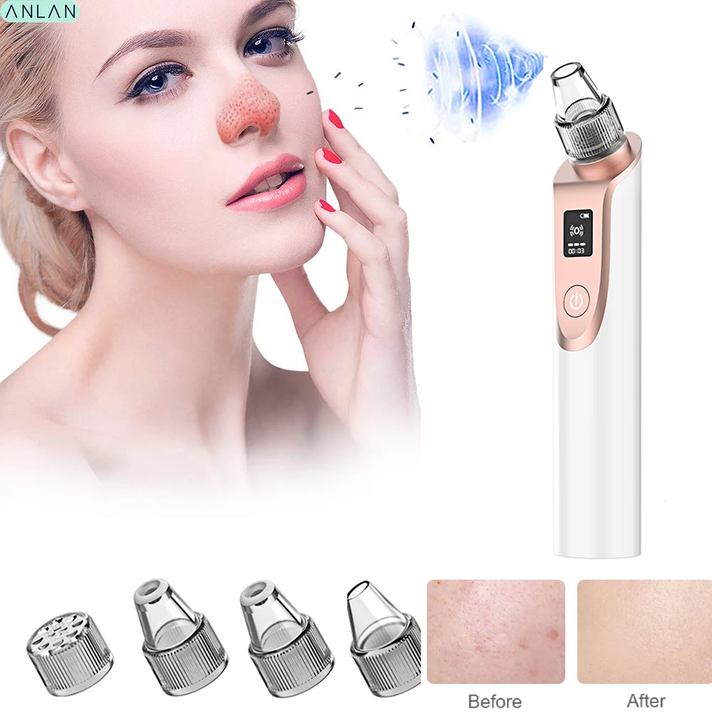 

Blackhead Remover Face Deep Pore Cleaner Acne Pimple Removal Vacuum Suction Facial Beauty Care Tool Skin Care Vacuum Acne