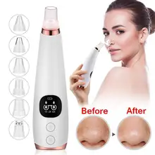 Средство для удаления черных точек лица, глубокие поры, акне Удаление прыщей вакуумный всасывающий алмазный инструмент для красоты