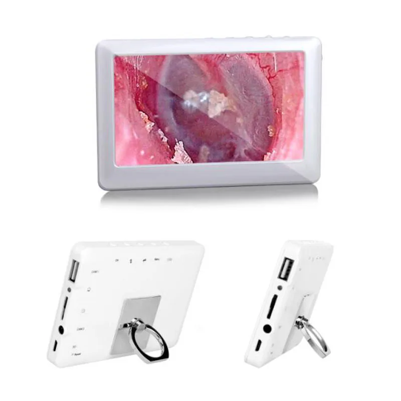 Рисунок 6 - Новинка, медицинский эндоскоп с экраном 4