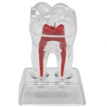 

Large Tooth Molar Model Separable Teaching Demonstration Model Transparent Dentistry Material Lab Teeth Model