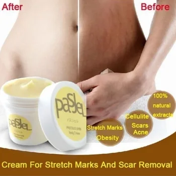 

Precious Skin Body Cream Stretch Marks Powerful Remove Scar Postpartum Obesity Pregnant Anti-Aging Cream Whitening Firming Body