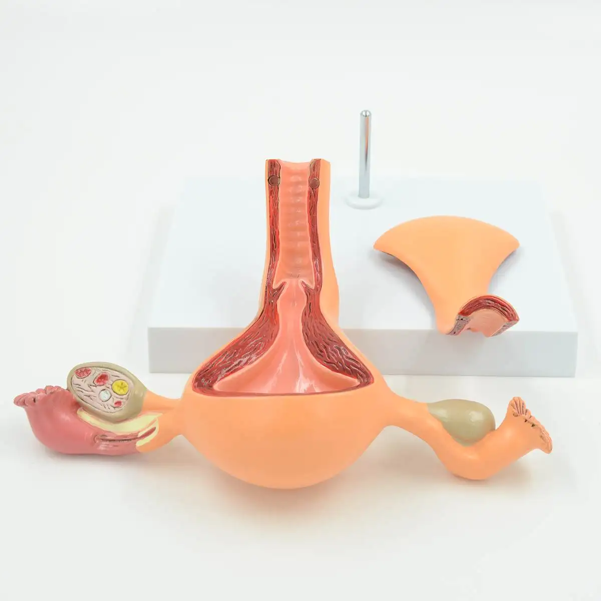 

2 Part Anatomical Healthy Human Female Uterus Ovary Model Women Medical Science Uterus Ovary Anatomy Model Educational Supply