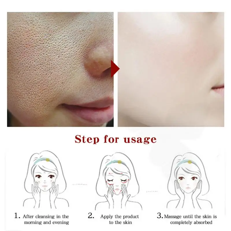 spesifikasi 10 Ml Witch Hazel Pori Mengurangi Esensi Firming Kulit Dalam Pelembab Mencerahkan Kulit Wajah Perbaikan Essence