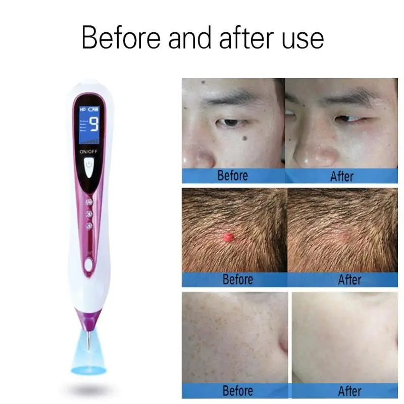 

Laser Freckle Removal Pen Skin Care Mole Dark Spot Remover for Face Wart Tag Tattoo Salon Beauty Machine face care tool