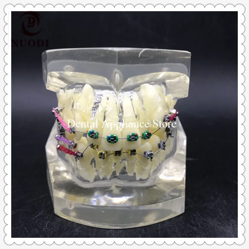 

Orthodontic teeth model M3005/Dental Orthodontic Study teeth Model with bracket and ligature wire for dentist use