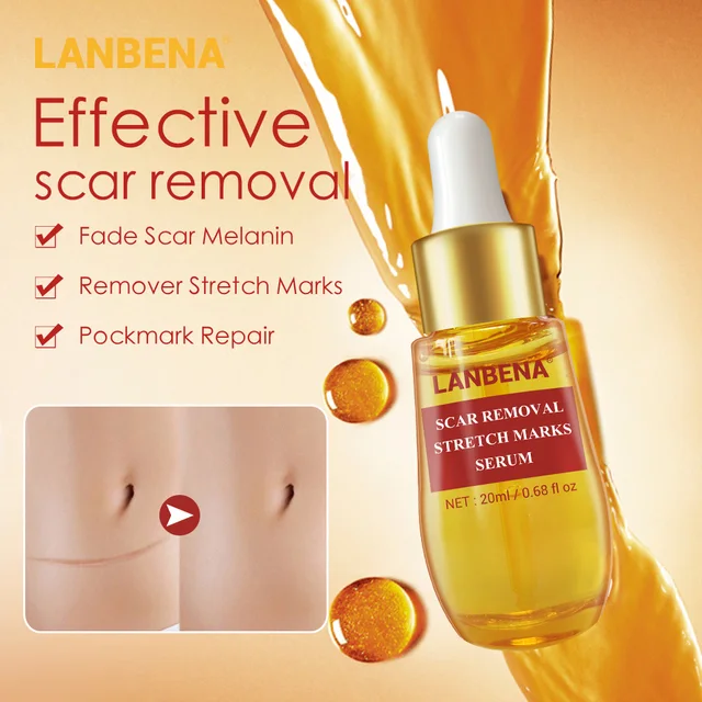 LANBENA Acne Scar Remove Cream Acne Treatment Whitening Serum Anti Acne  Repair Stretch Marks  Skin Shrink Pores Face Care 2pcs