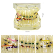 Dental Orthodontics Teeth Model Dentist Teaching Training Malocclusion Orthodontic Teeth Model with Brackets Buccal Tubes Chain