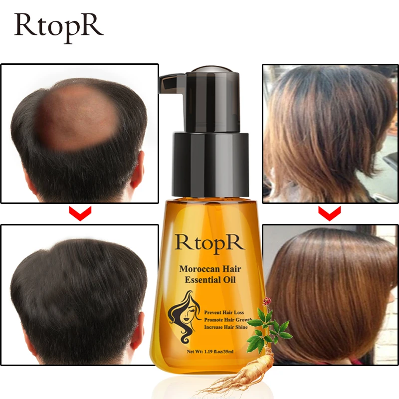 35 мл Morocco волос эфирное масло многофункциональное от выпадения волос Быстрый мощный рост волос EssenceTSLM1