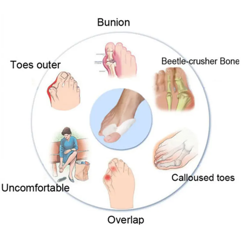 Silicone Gel Bunion Protector Toe Straightener Separator Alignment Pain Relief Thumb Corrector Orthotics Feet Care 1 Pair