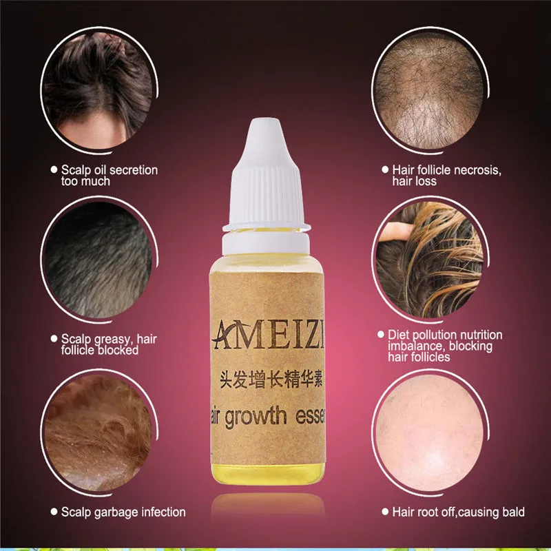 Распродажа ameizii средство для роста волос выпадение волос жидкость 20 мл густые волосы быстрый подсолнух