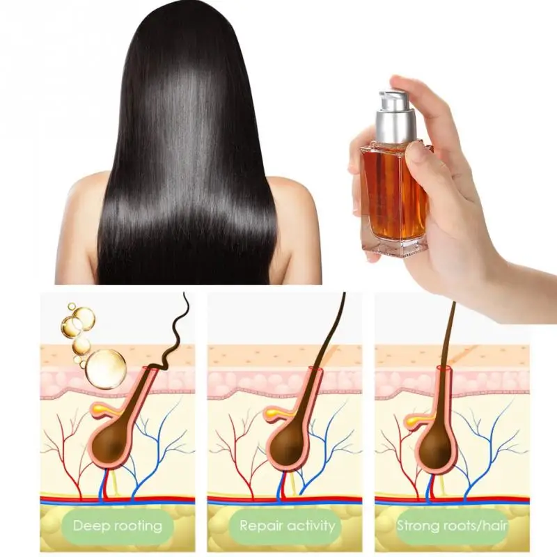 haar wachstum essenz ginseng kopfhaut gesundheit haarausfall behandlung fl ssigkeit anti haarpflege produkt massage a65