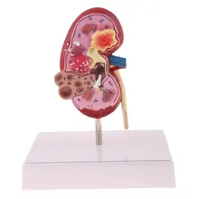 Человеческая почка модель структура с база медицинский анатомический модель для школы обучающий инструмент обучения дисплей лабораторные принадлежности
