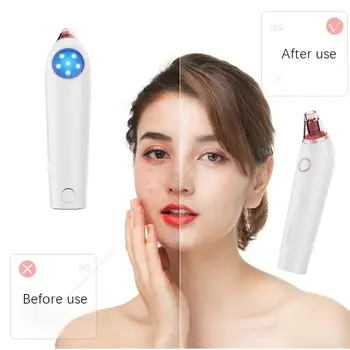 

Xpreen Blackhead Remover Skin Care Pore Vacuum Acne Pimple Removal Vacuum Suction Tool Facial Diamond Dermabrasion Machine