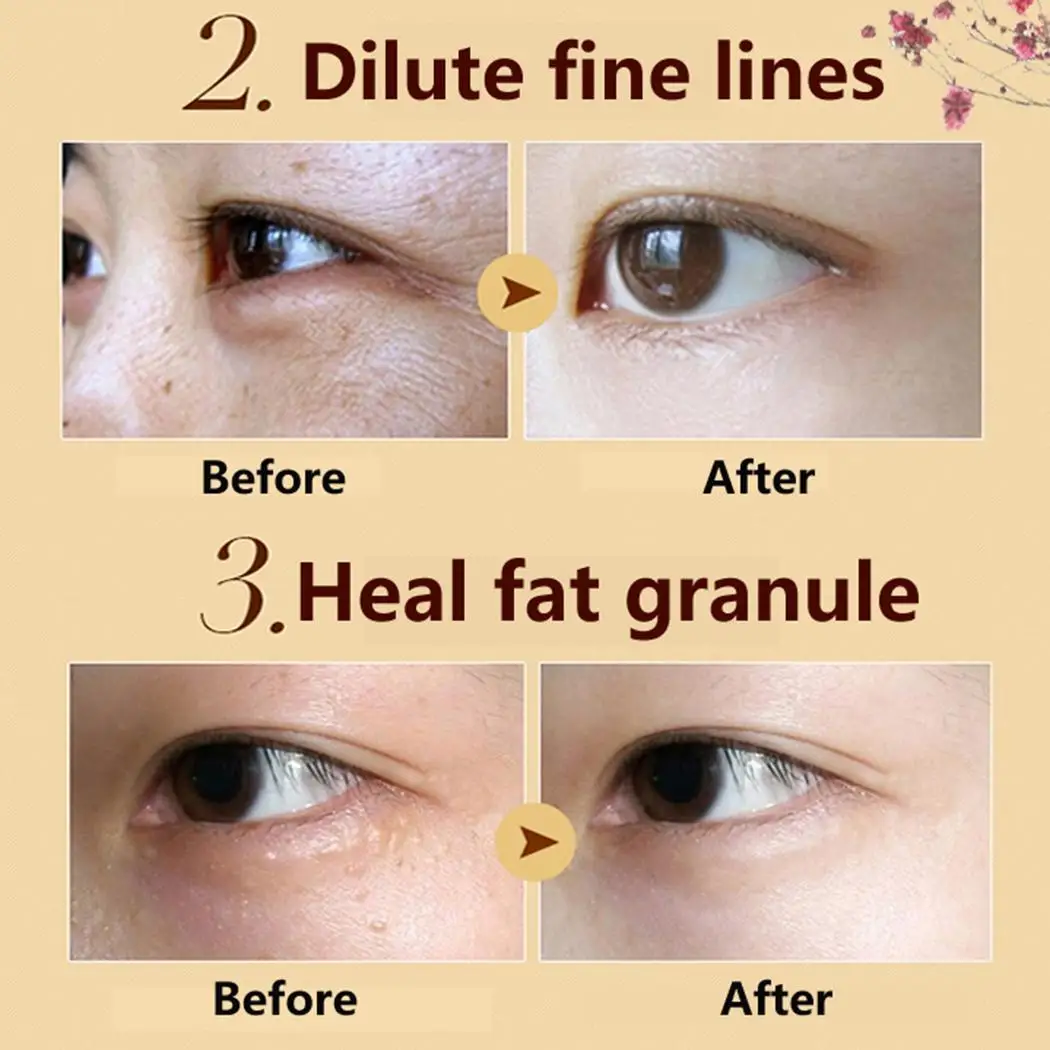 Murah Kulit Perawatan Pelembab Anti Aging Anti Bengkak Crystal Kolagen Pasta China Witch Hazel Mata 6 G pair Masker Umum