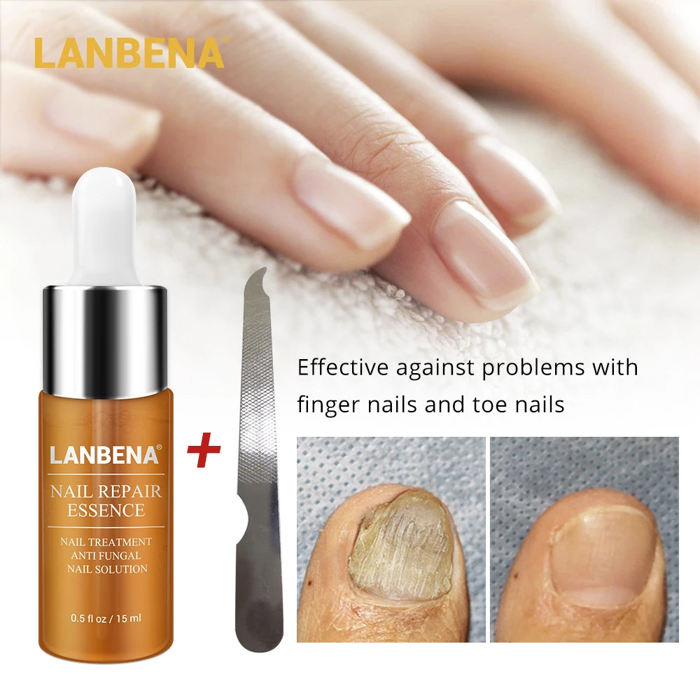 

LANBENA Nail Repair Essence Serum Fungal Nail Treatment Remove Onychomycosis Hands and of Toe Nail Nourishing Brighte Foot Care