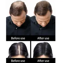 Salon Beauty Toppik Hair Fiber Keratin 27.5g Hair Building Fibers Powder Hair Loss Concealer Hair Care Growth Products Salon Beauty Toppik Hair Fiber Keratin 27.5g Hair Building Fibers Powder Hair Loss Concealer Hair Care Growth Products