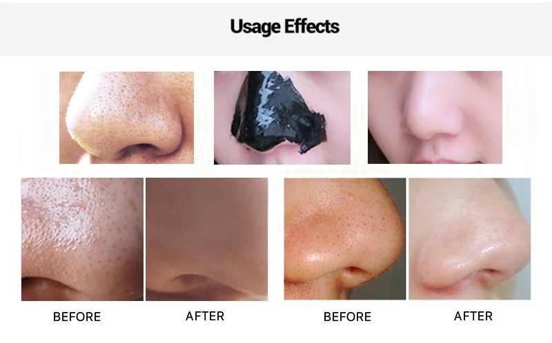 AUQUEST Hyaluronic Acid  Blackhead Face Cream Acne Treatment Mask Deep Cleaning Shrink Pores Oil Control Whitening Skin Care