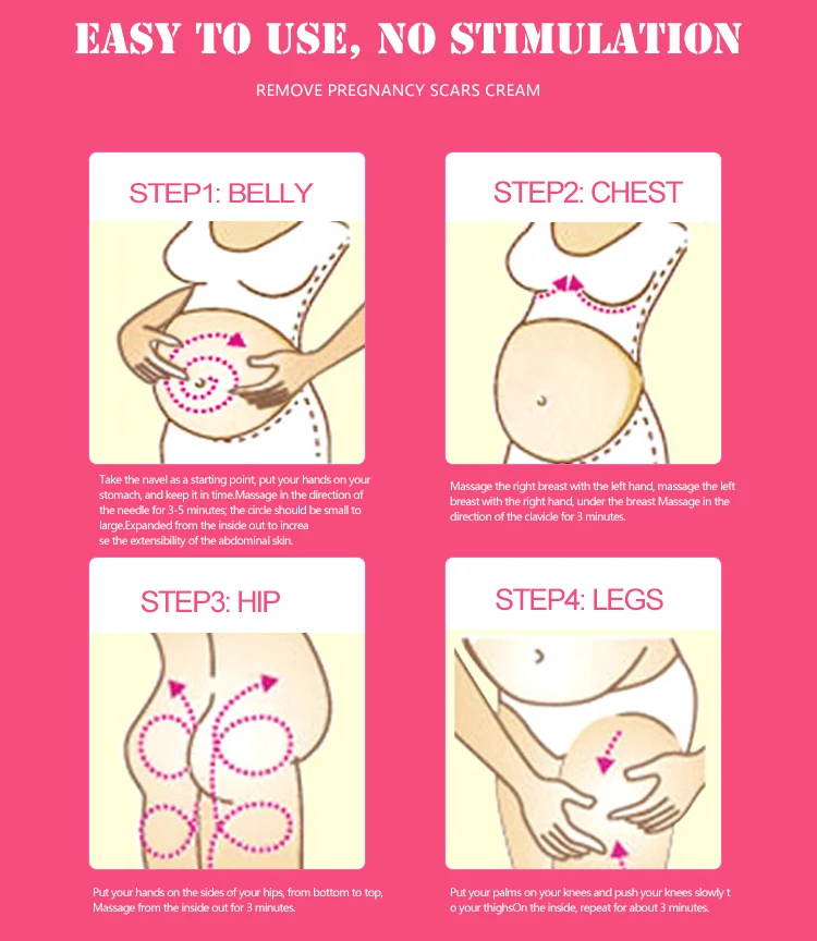 30 мл мощное средство для Удаления растяжек эфирное масло для удаления шрамов при беременности крем для восстановления гладкой кожи тела CreamTSLM1