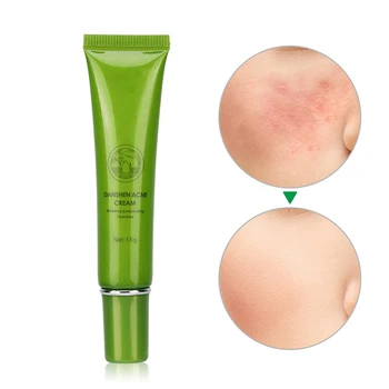 

Acne Removal Cream Blackhead Pimple Removal Moisturizing Refreshing Lotion
