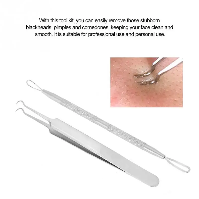 Stainless Steel Blackhead Removal Tool Kit Curved Tweezers Looped Double End Pimple Extractor Home Use Beauty Devices Aliexpress