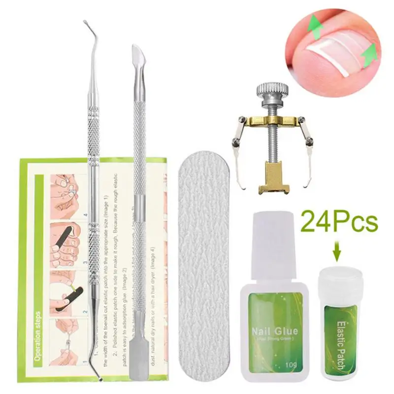 

24pcs /Set Ingrown Toenail Correction Tool Set Ingrown Toe Nail Pedicure Elastic Patch Straightening Clip Brace Bunion Corrector