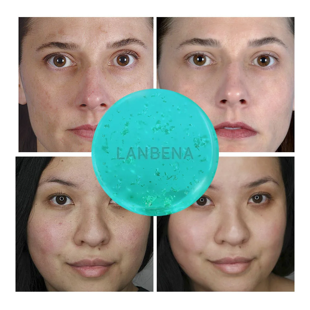 “ Tratamento da Acne Limpeza Hidratante Anti-rugas Aning Lanbena