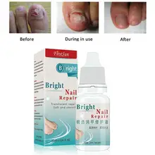 XY Fancy Крем для лечения грибка ногтей Onychomycosis Paronychia противогрибковые инфекция ногтей ног Лечение ногтей