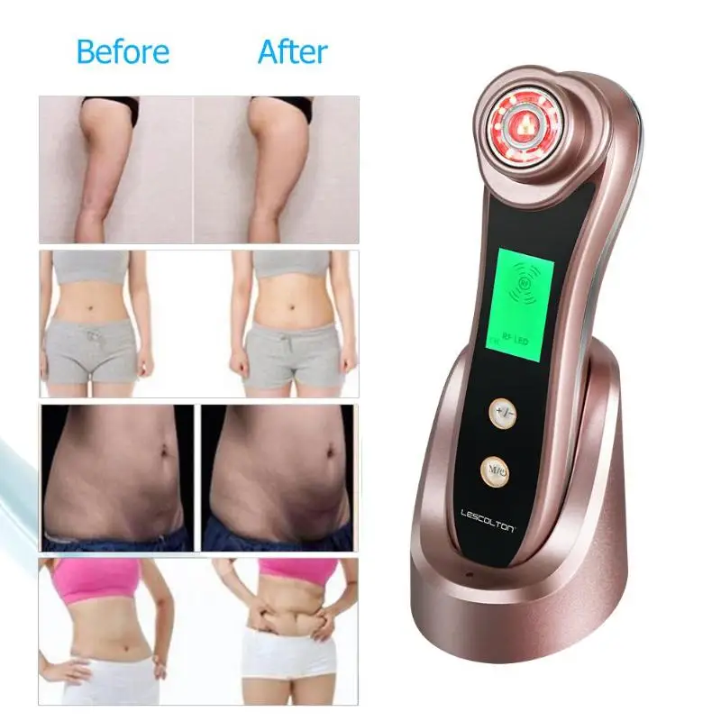 

5 in 1 RF&EMS Radio Mesotherapy Electroporation Beauty Device Radio Frequency Photon Face Skin Rejuvenation Remover Wrinkle