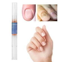 3 мл ногтей грибок лечение жидкости онихомикоз восстанавливающая жидкость противогрибковые пальцы рук и ног Уход за ногтями