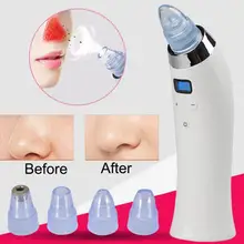 1 комплект электрический удаление угрей присоска черный акне роговой угрей увлажняющий бытовой очиститель пор