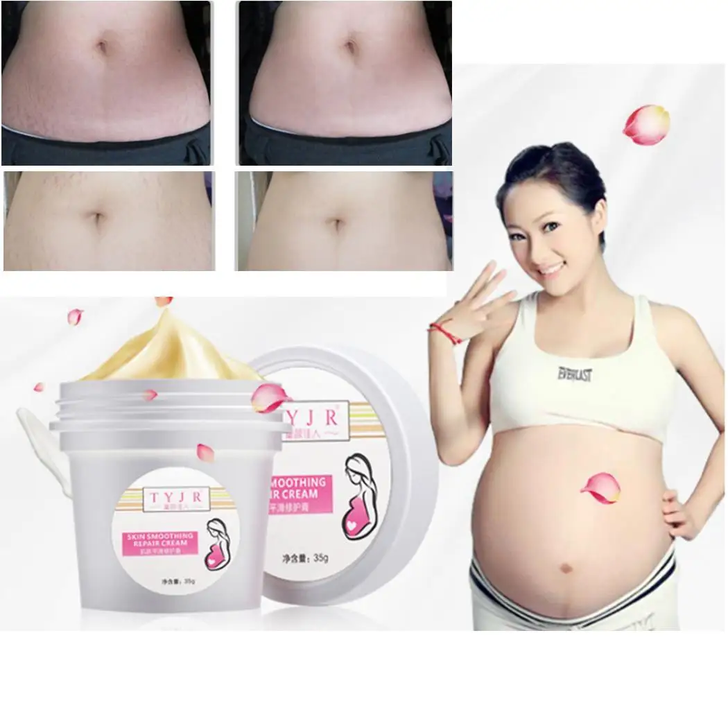 Smoothing Moisturizing Repair Mark Natural Cream Woman Skin Types Postpartum repair of stretch marks cream | Красота и здоровье