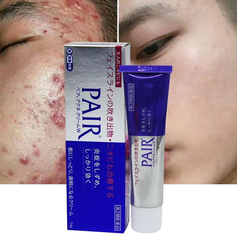 Original Best Japan Lion Pair Acne Medicated ครีมครีมครีมหน้าสำหรับสิวสิว  Treatment Skin Care W 14g 24g| | - AliExpress