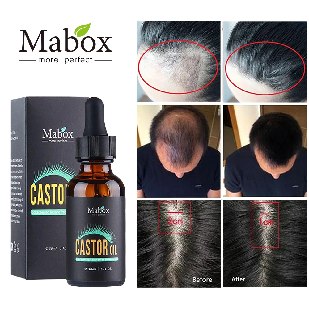 MABOX Fast Powerful Hair Growth Essence Products Essential Oil Liquid Treatment Preventing Hair Loss Hair Care Andrea 30ml